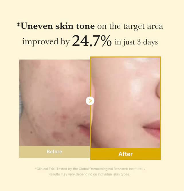 قناع ليلي للتغليف بحمض الكوجيك والكركم من ميديكيوب 75 مل