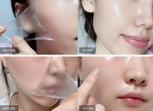 قناع الكولاجين اليلي من ميديكيوب75 مل