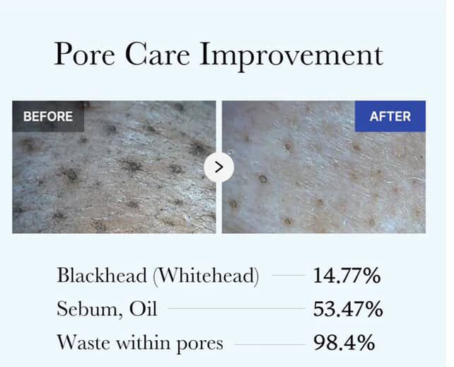 قناع الطين من ميديكيوب 100 مل